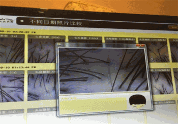 菩叶头皮抗衰产品 门店图片