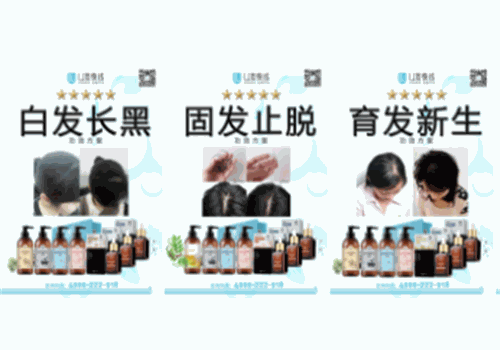 U发快线养发