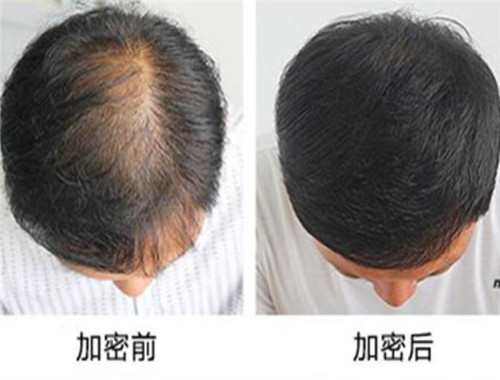 美黛丽丝生态无痕补发产品 门店图片