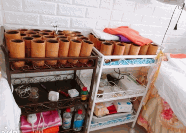 藏药竹罐减肥产品 门店图片