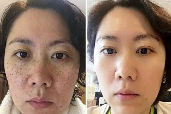 格兰朵套盒美容院产品 门店图片