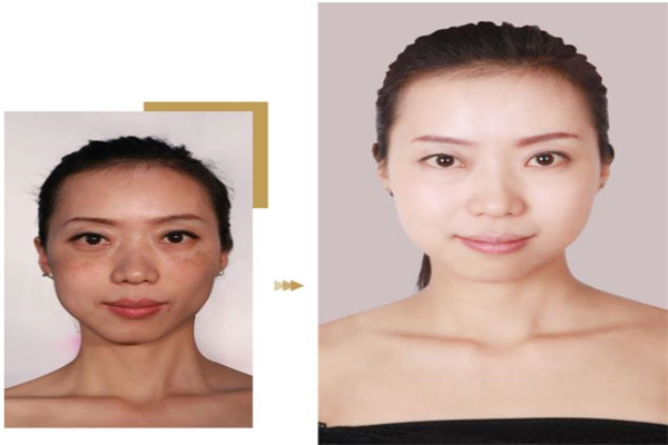 光感美肌祛斑产品 门店图片
