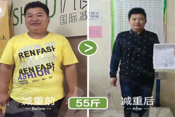 西米优瘦身产品 门店图片