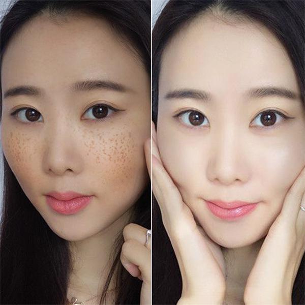 痣仁堂