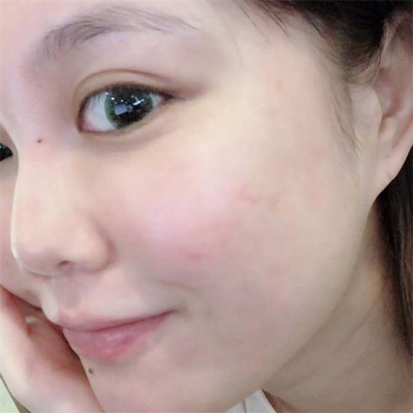 痣仁堂
