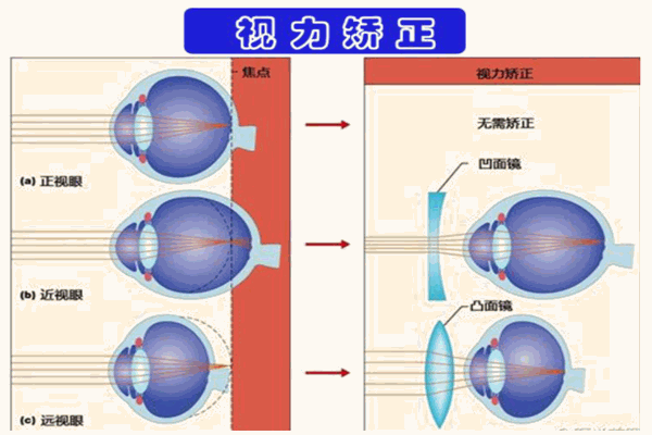 中子镜