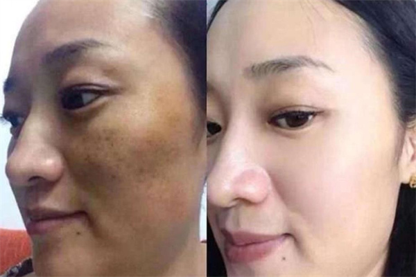 菲诗奇迹产品 门店图片