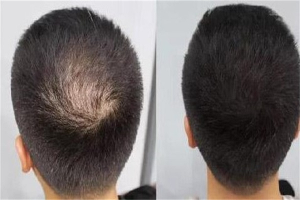 黑米3d纹发产品 门店图片