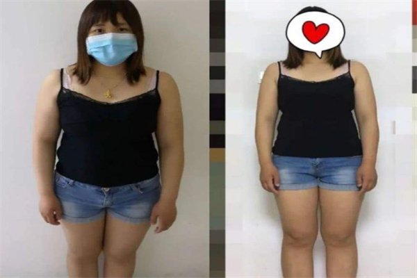锦绣围度女子专业减肥产品 门店图片