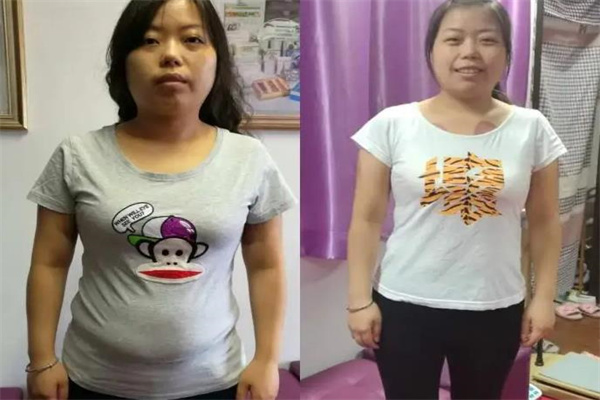 蔓城俏瘦美人产品 门店图片