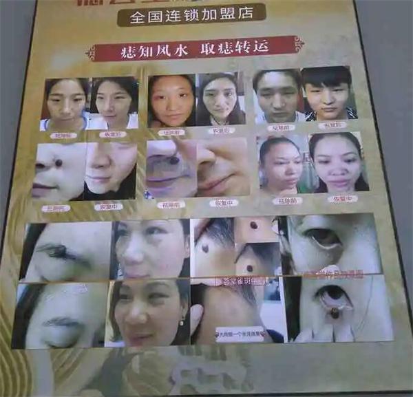 痣仁堂