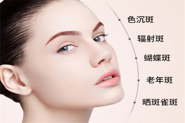 诗淇美颜祛斑产品 门店图片