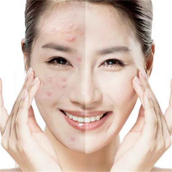 秀肤生皮肤管理加盟条件难么？流程多么