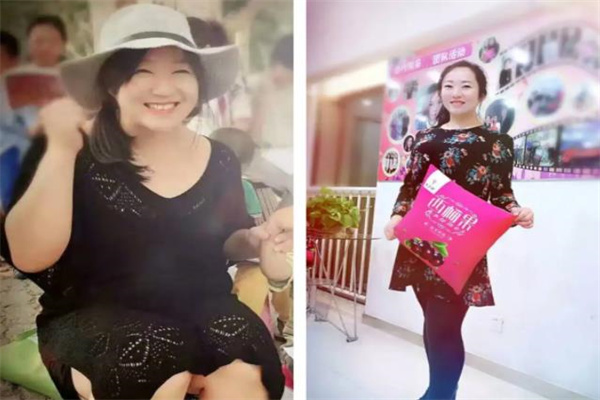 秀丽佳人减肥产品 门店图片