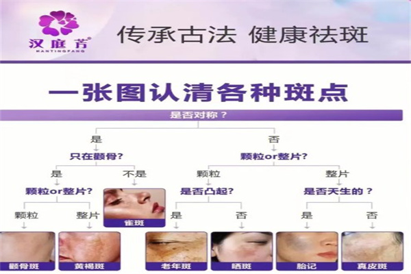 汉庭芳祛斑热线是多少？官网能查到