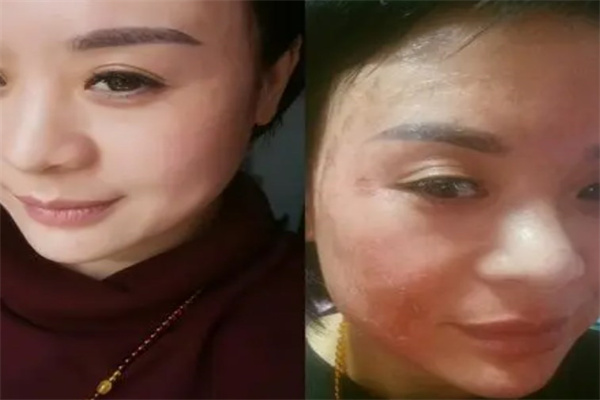 汉庭芳祛斑热线是多少？官网能查到
